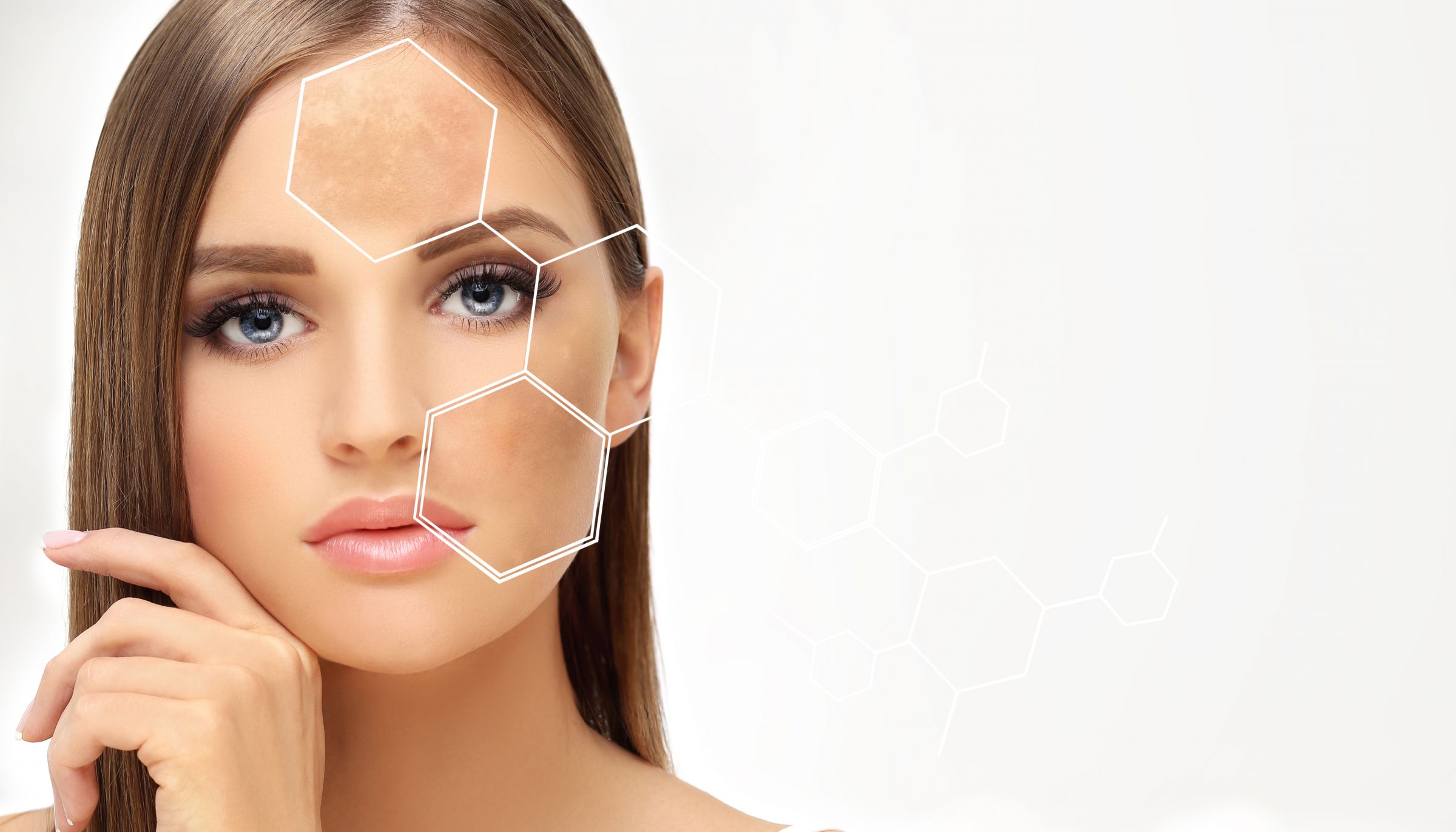 Транексамовая кислота